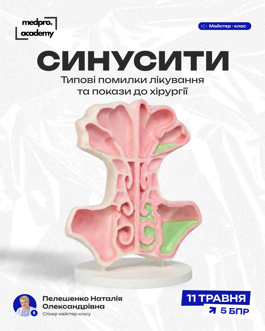 3Синусити типові помилки лікування та покази до хірургії